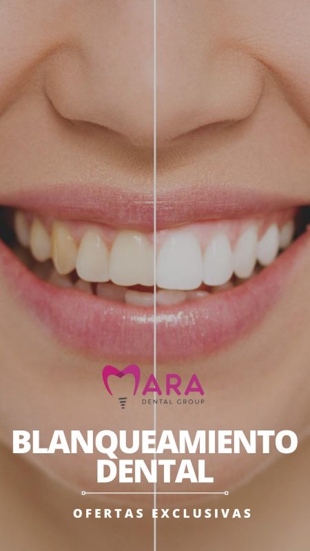 Cómo mantener una sonrisa sana